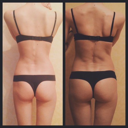 Плоские ягодицы