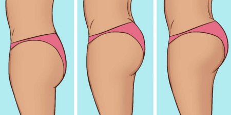Формы женских ягодиц