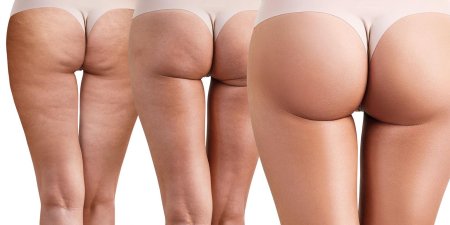 Женские ягодицы