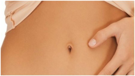 Пупочные грыжи