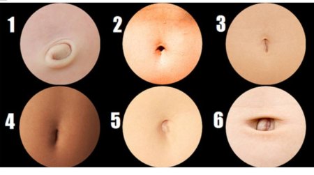 Форма пупка