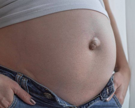 Выпуклый пупок у беременных