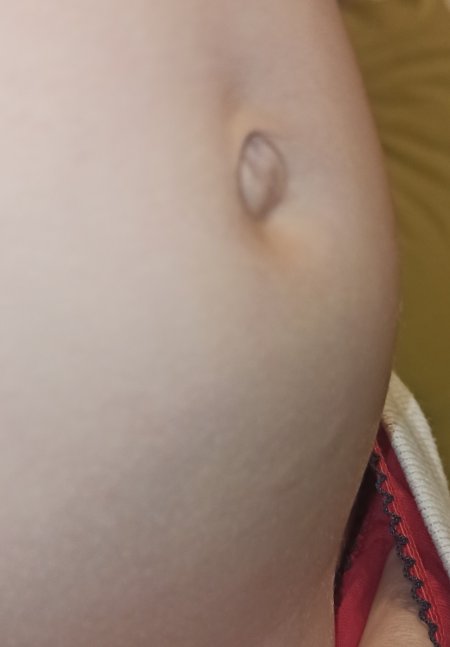 Выпуклые пупки