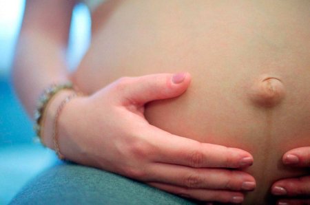 Невправимая пупочная грыжа