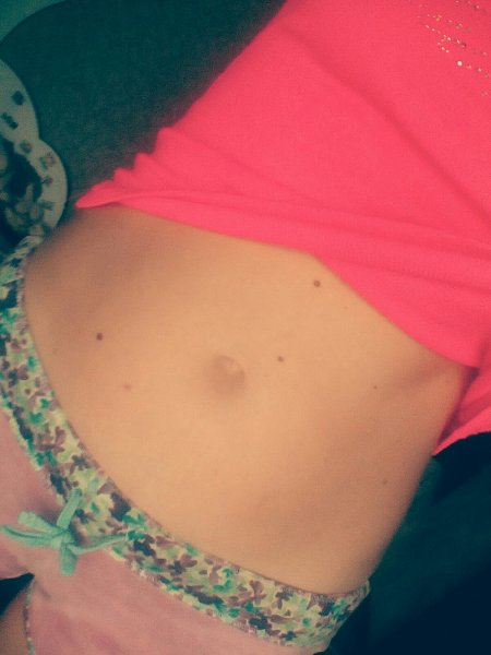 Некрасивый пупок у девушки