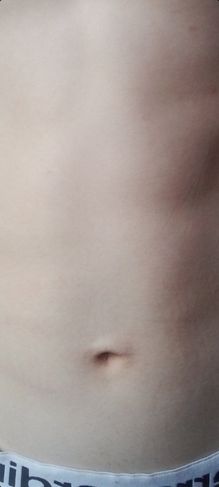 Выпуклые пупки