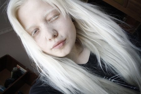 АНАСТАСИЗ ВИННЕЙ альбинос