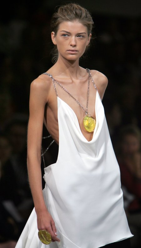 Каролина Рестон анорексия