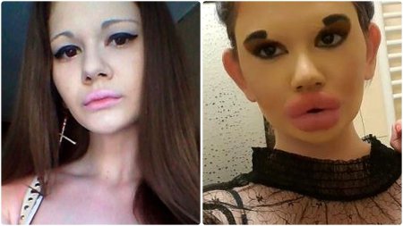 Губастые женщины