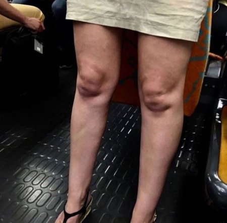 Некрасивые ноги