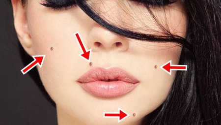 Красивые родинки на лице