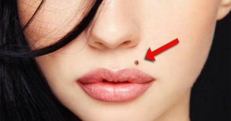 Родинка над верхней губой
