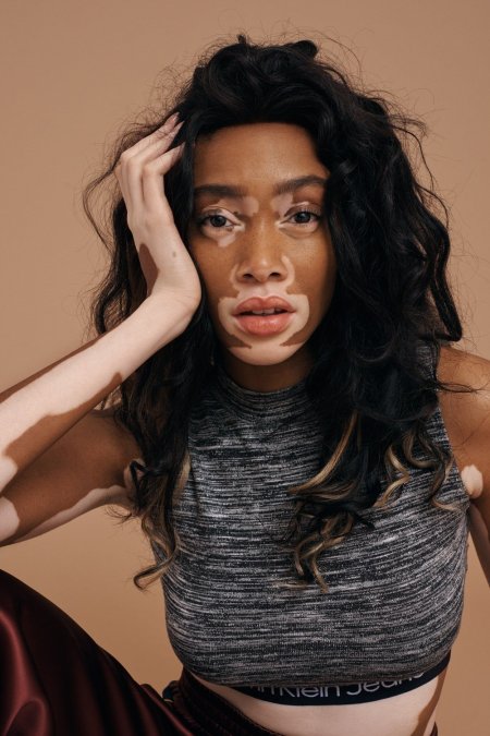 Winnie Harlow