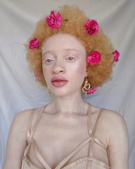 Негр альбинос модель