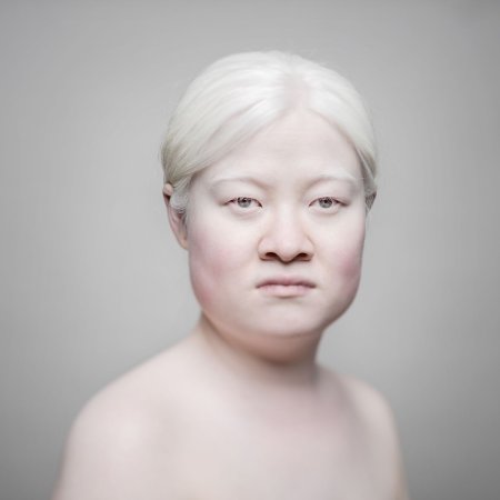 Кореец альбинос