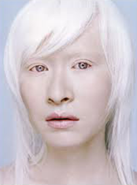 Монголоиды альбиносы