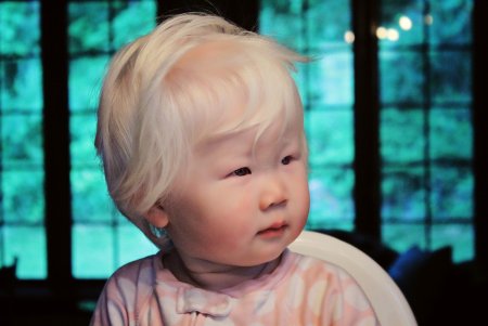 Мальчик альбинос