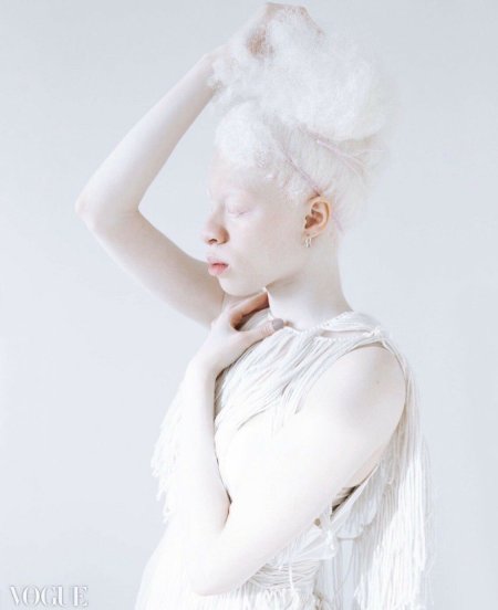 Анастасия Жидкова альбинос