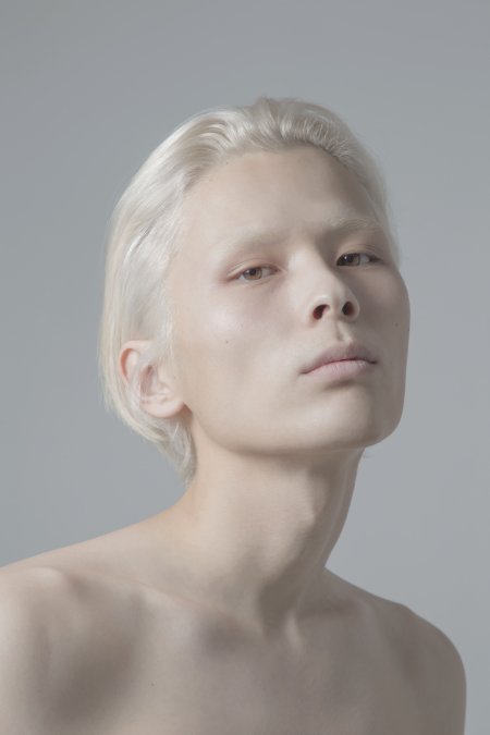 Монголоиды альбиносы