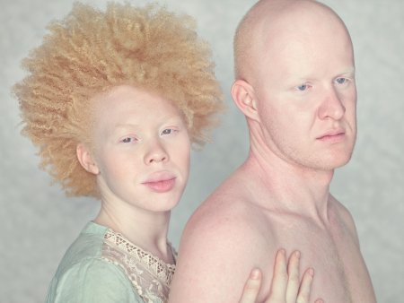 Катерина Тимошенко альбинос