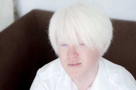 Азиаты альбиносы