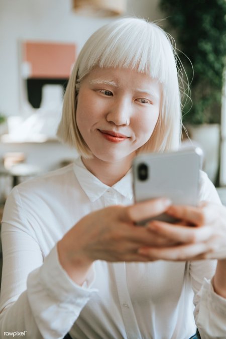 Кореец альбинос