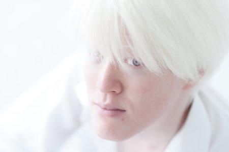 Альбинос Корея певец