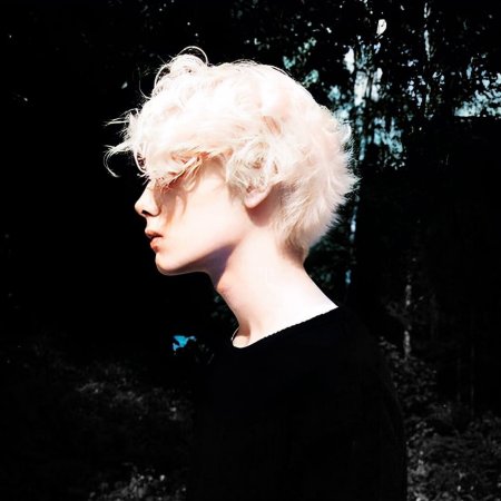 Альбинос парень