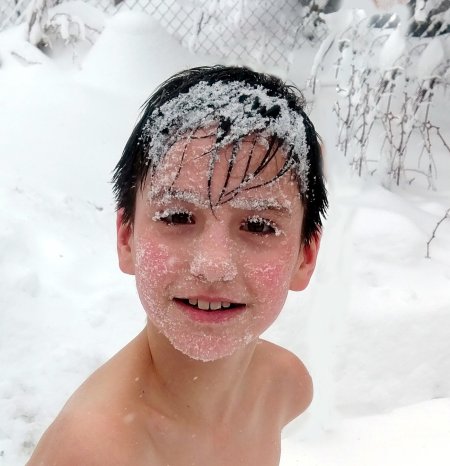 Закаливание снегом