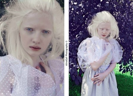 Настя Комарова модель альбинос