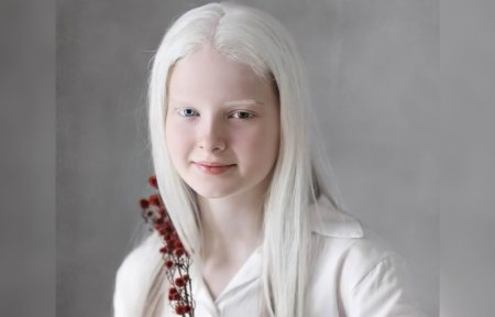 Амелия ньюсхэм альбинос