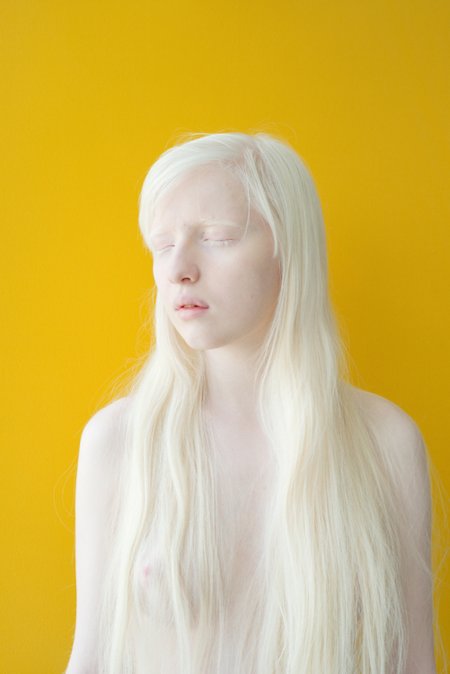 Амелия ньюсхэм альбинос