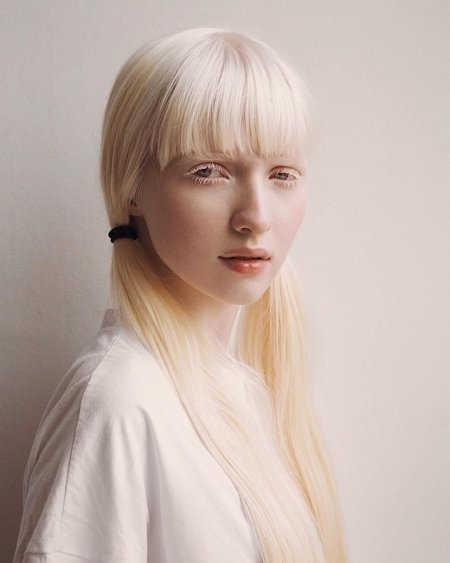 Анна Шота альбинос