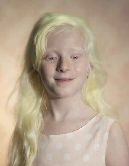 Амелия ньюсхэм альбинос