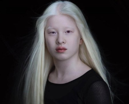 Сюэли альбинос