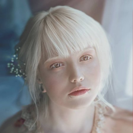 Анастасия Жидкова альбинос