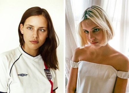 Девушки с косоглазием