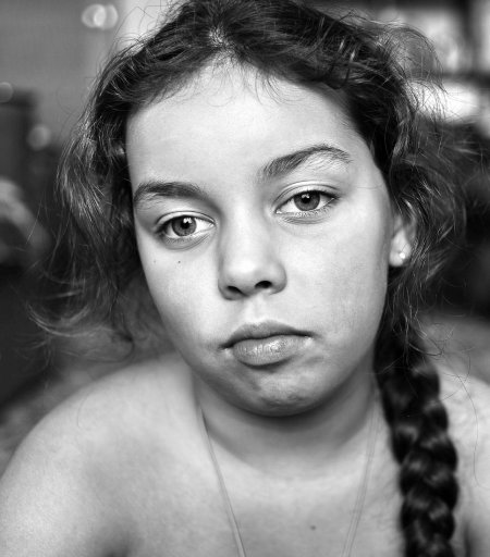 Девочка с косыми глазами