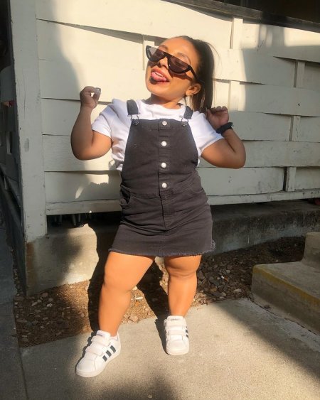 Карлик девочка