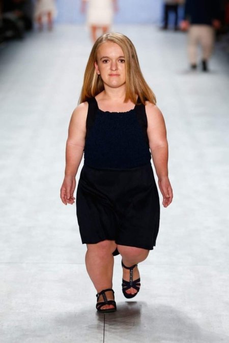 Карликовые люди