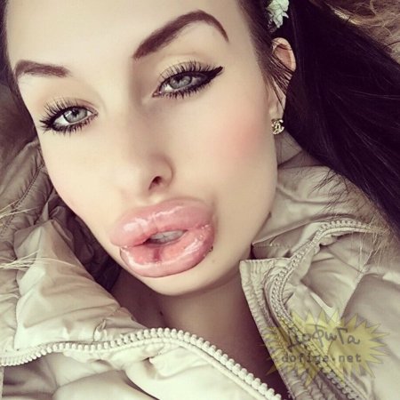 Накаченные губы