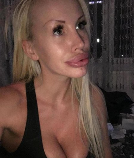 Силиконовые губы