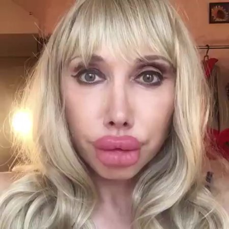 Елена Воробей губы