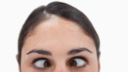 Косые глаза