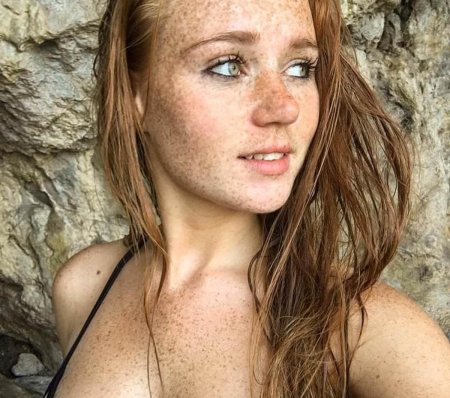 Веснушки на груди