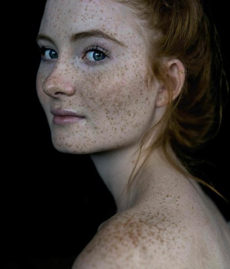 Freckles Джуди
