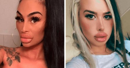 Губошлепка Кайли