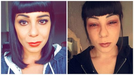 Аллергич на наращенные речницы