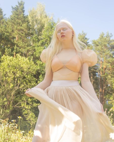 Альбиноска девушка