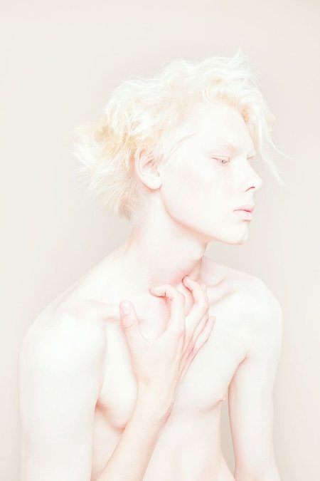 Игорь Клепнев альбинос